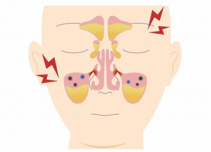 特殊な副鼻腔炎