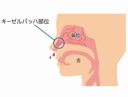 物理的刺激・外傷
